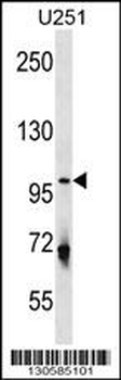 ULK1 Antibody (Center S556)