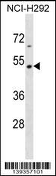 TEKT2 Antibody (N-term)