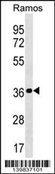 MRPL19 Antibody (N-term)