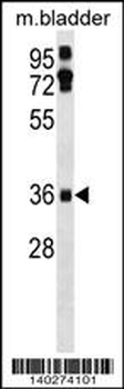 Mouse Ei24 Antibody (C-term)