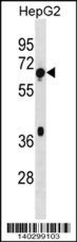 TBC1D3F Antibody (Center)