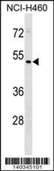 HEPACAM2 Antibody (C-term)
