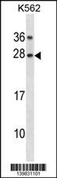 GAR1 Antibody(Center)
