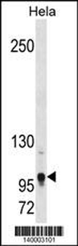 Mouse Tshz1 Antibody(Center)