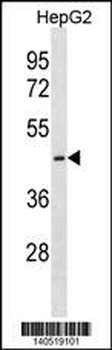 CTNS Antibody(C-term)