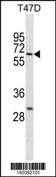 DDX41 Antibody(N-term)