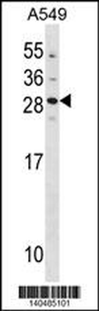 GUCA1B Antibody(N-term)