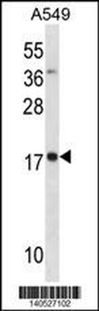 MYL4 Antibody(N-term)