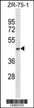 ST6GALNAC5 Antibody(C-term)