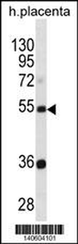 TEKT3 Antibody(N-term)