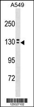 OVCH1 Antibody(N-term)