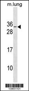 RBM7 Antibody(C-term)