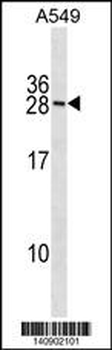 RNF182 Antibody(N-term)