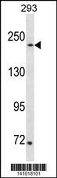SETD1A Antibody(Center)