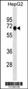 ANKDD1A Antibody(C-term)