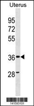 ZC3HAV1L Antibody(C-term)