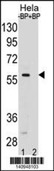 SMAD5 Antibody(Center)