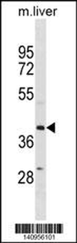 ZFP36L1 Antibody(N-term)