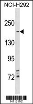 TSC2 Antibody (N-term)