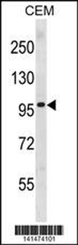 PGR Antibody (Center)
