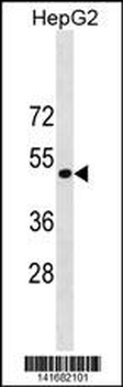 ST6GAL1 Antibody (Center)