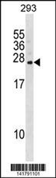 FKBP14 Antibody (C-term)