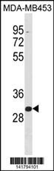 ZNF367 Antibody (C-term)