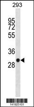 SDHB Antibody (C-term)