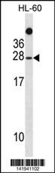 TAF11 Antibody (N-term)