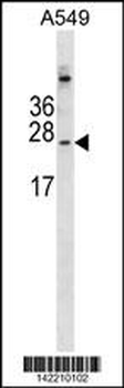 CALML6 Antibody (Center)