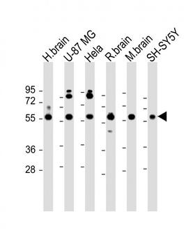 GDI1 Antibody (C-term)