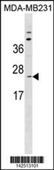 SC11A Antibody (Center)