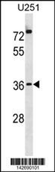 POPD3 Antibody (C-term)