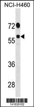 DDX19B Antibody (N-term)
