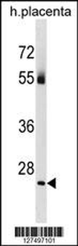 TBC1D26 Antibody (C-term)