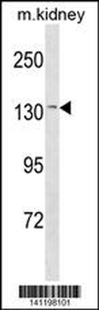 CASR Antibody (Center)