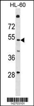 T161A Antibody (N-term)