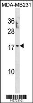PTRH2 Antibody (N-term)