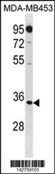 MTAP Antibody (N-term)