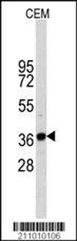 GAPDH Antibody
