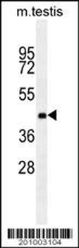 ZNF622 Antibody