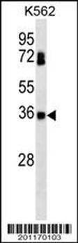 CSNK2B Antibody