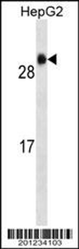 GSTA1 Antibody