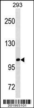 B3GAT1 Antibody