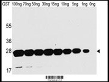 GST Antibody