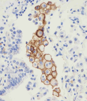 PD L1 Monoclonal Antibody (PDL1)