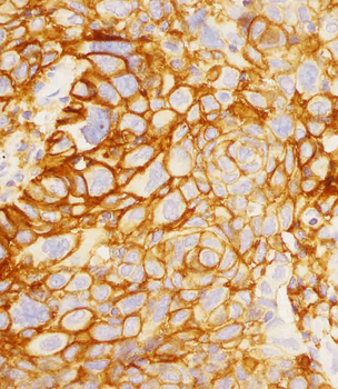 PD L1 Monoclonal Antibody (PDL1)