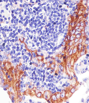 PD L1 Monoclonal Antibody (PDL1)