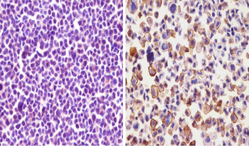PD L1 Monoclonal Antibody (PDL1)