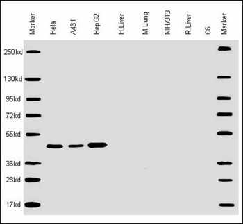 CYK18 Antibody (C-term)